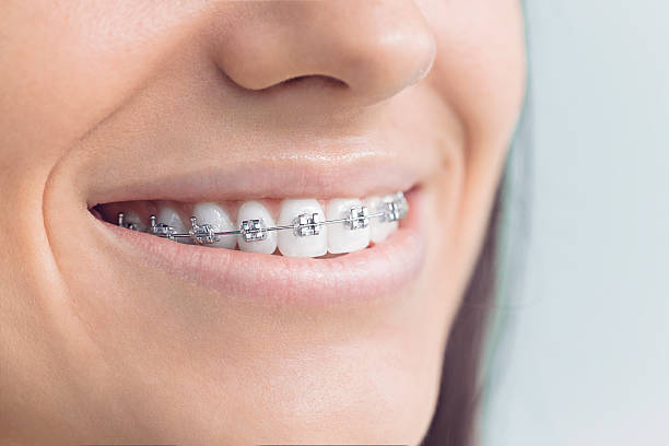 Best Full Mouth Reconstruction  in Sisseton, SD